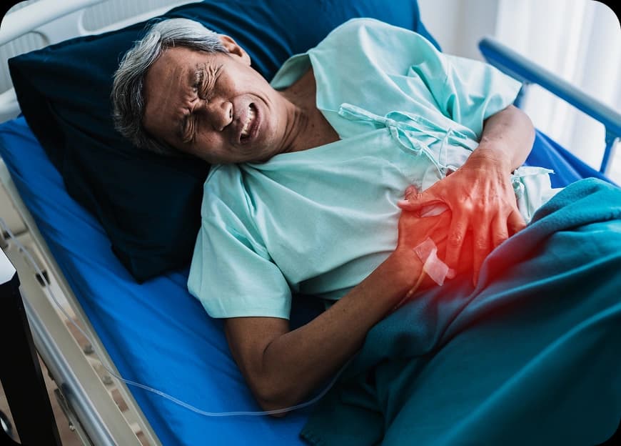 Causes of Bile Duct Cancer