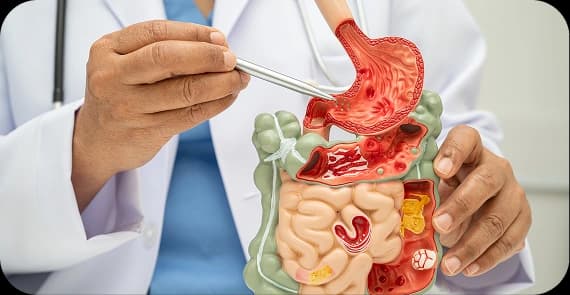 Peritoneal Mesothelioma