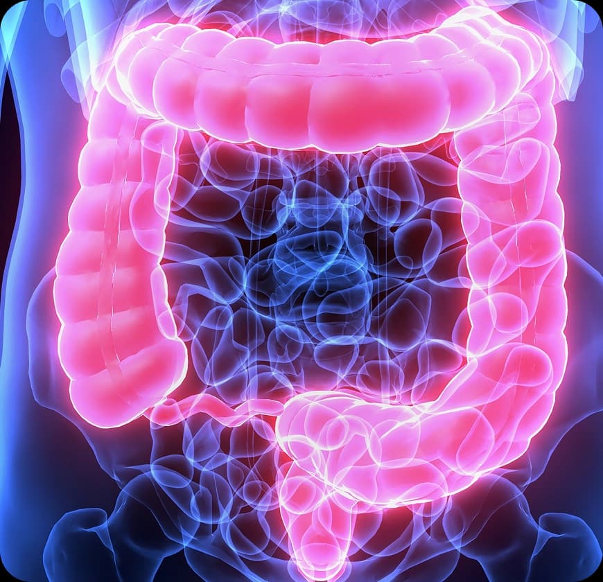 What Are The Causes And Risk Factors Of Colon Cancer?
