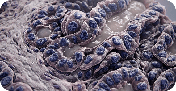 Adenocarcinoma & Other Rare Carcinomas 