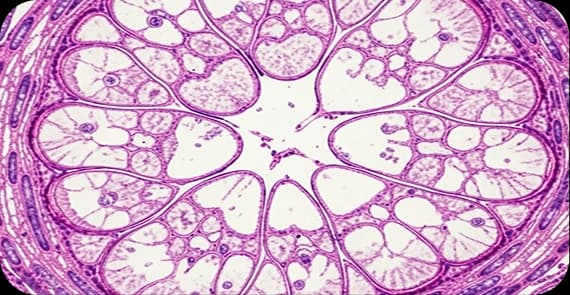Glottic Cancer