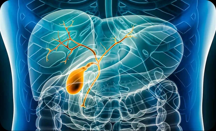 What Is Bile Duct Cancer?