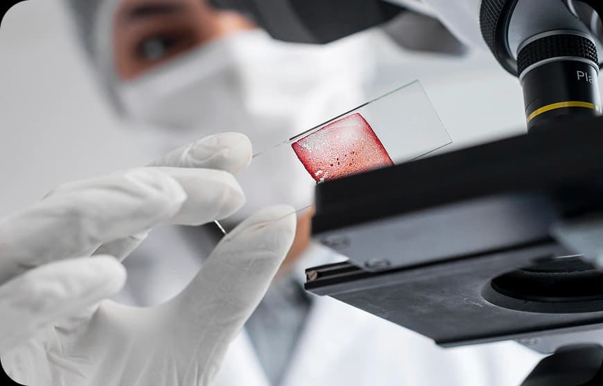 How is Anal Cancer Diagnosed?