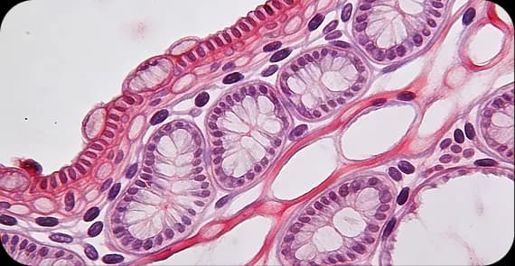 Sex Cord-Stromal Tumours