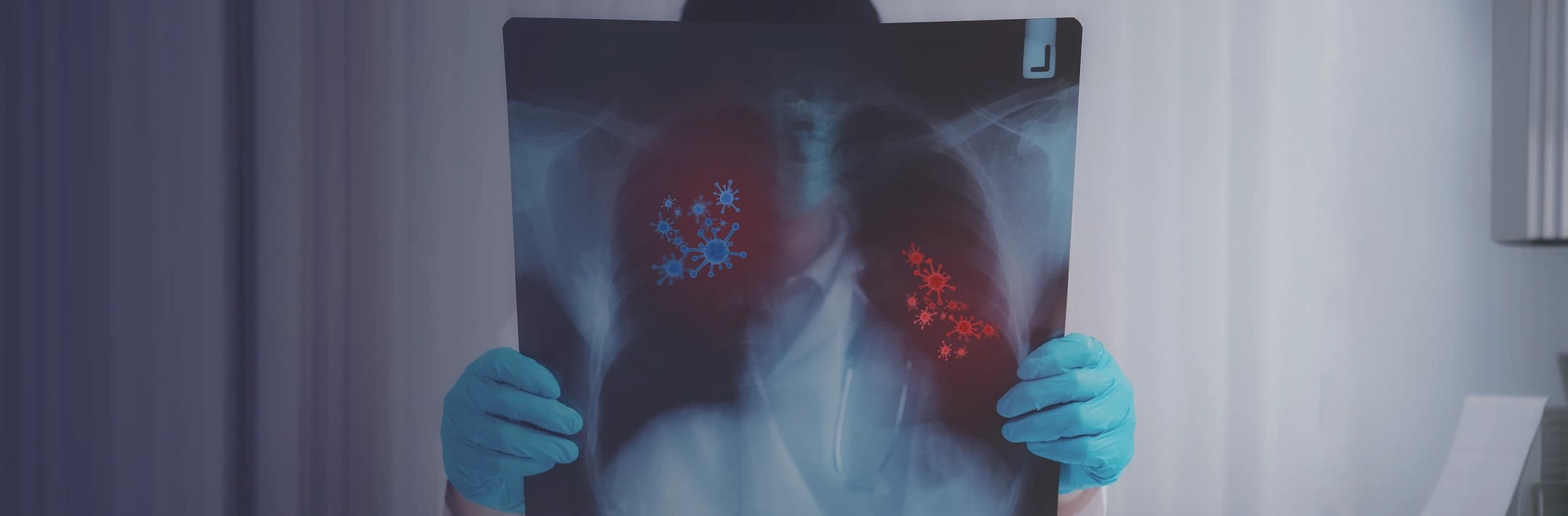 Malignant Mesothelioma Cancer