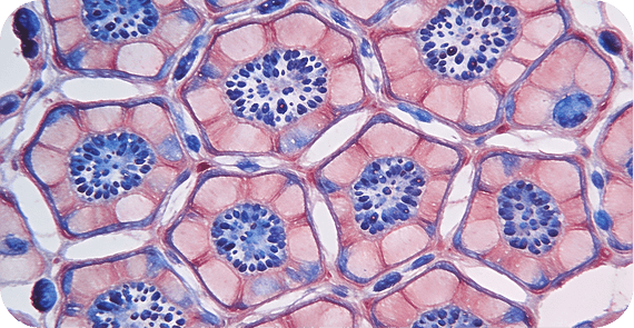 Pancreatic Neuroendocrine Tumours (PNETs)