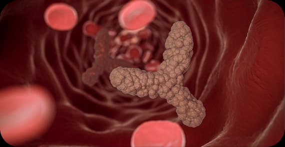 Renal Cell Carcinoma