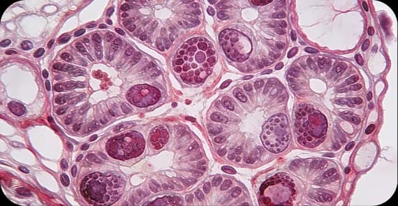 Germ Cell Tumours 