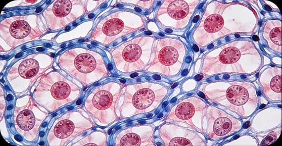 Carcinoid Tumour